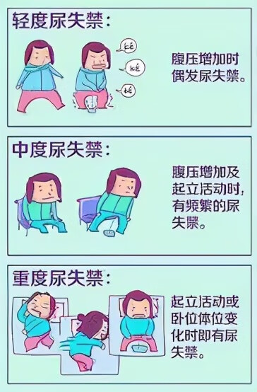 尿失禁分度盆底训练经过上述方法进行评估,同时经过医生进行检查,排除