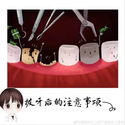 拔牙后的注意事项(拔牙后需要注意什么)