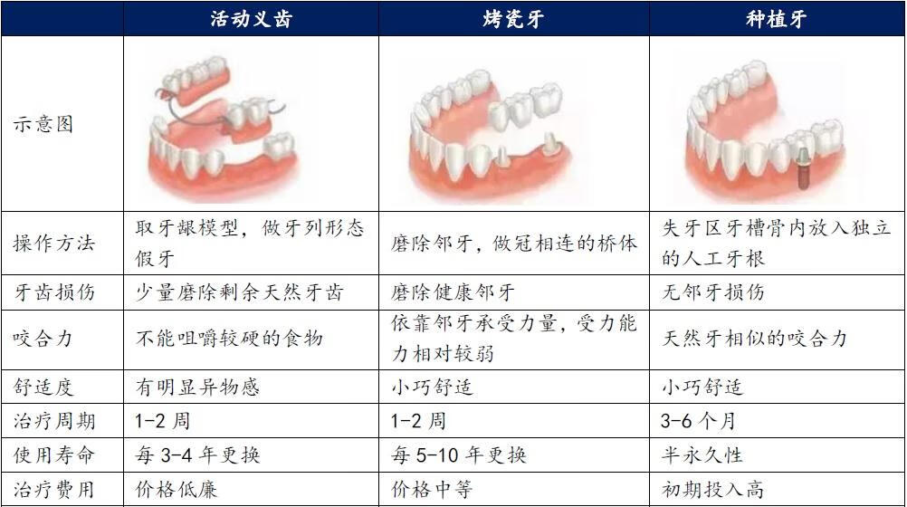 镶一颗牙多少钱(镶牙一颗多少钱)