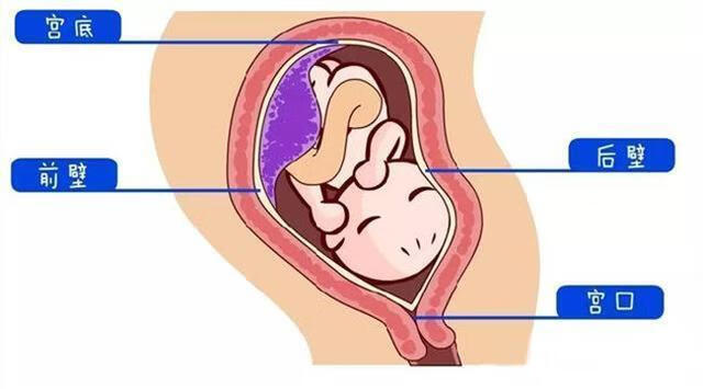 胎盘位于子宫前壁是什么意思(胎盘位于子宫前壁及宫底)