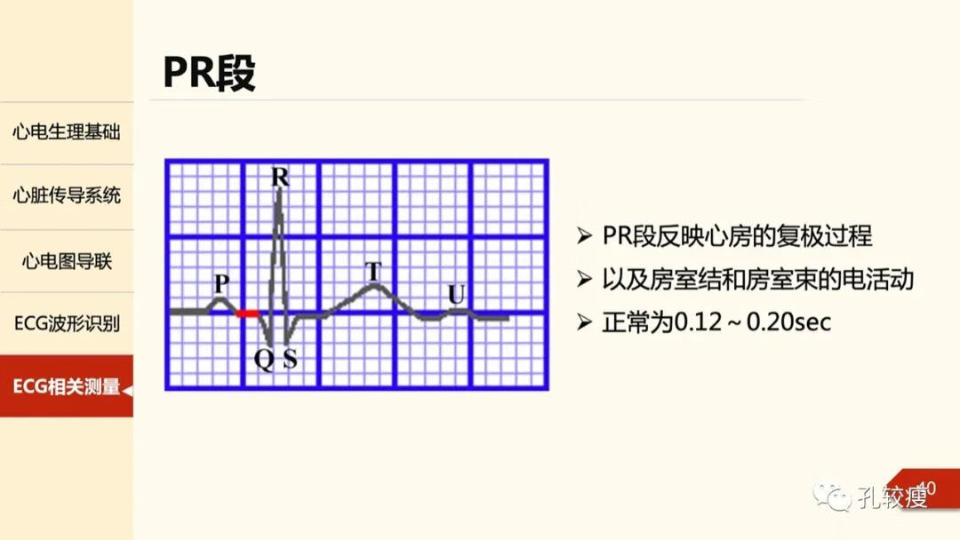 心电图导联位置示意图(心电图机导联位置图)