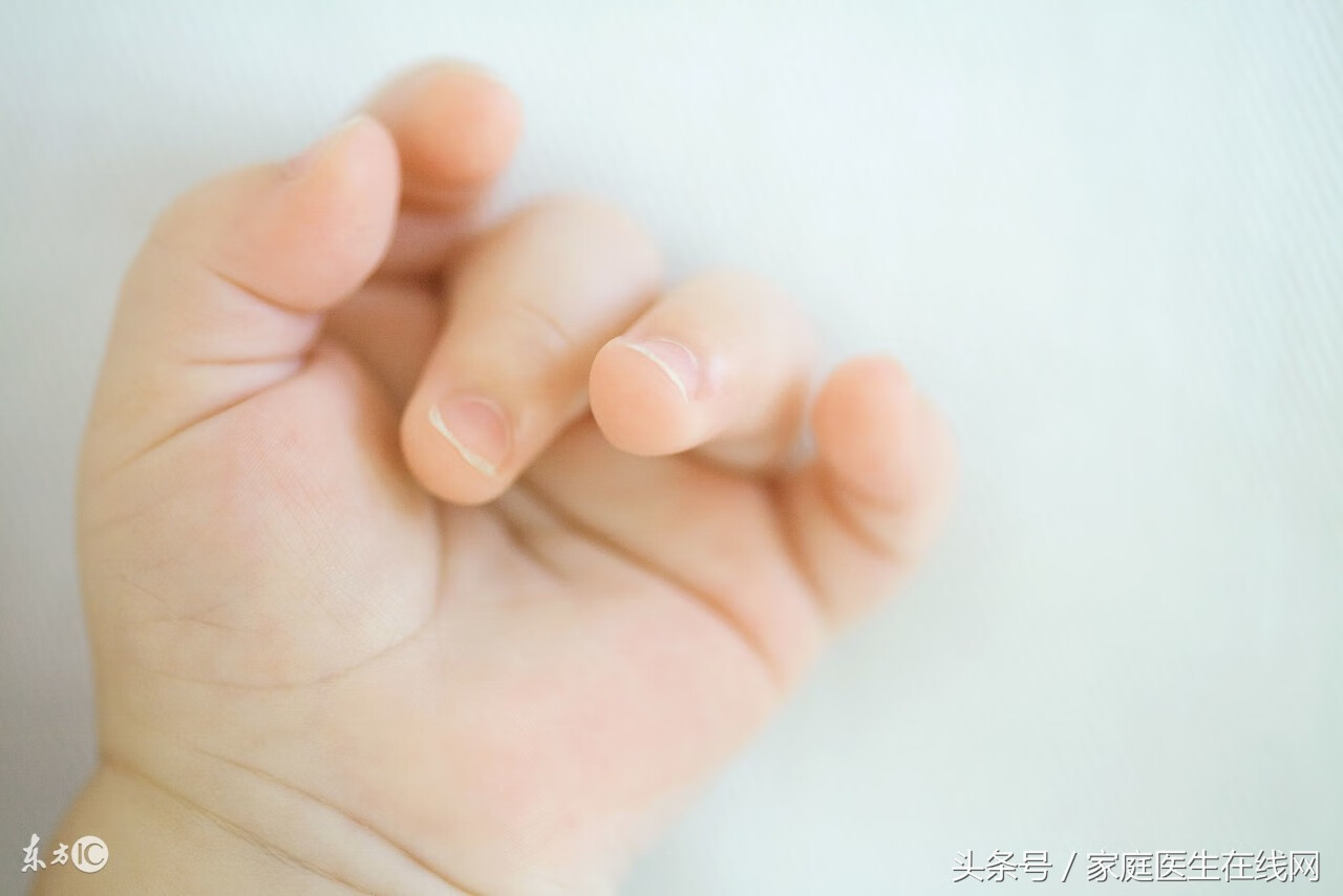 手指甲没有月牙代表什么(指甲上几乎没有月牙)