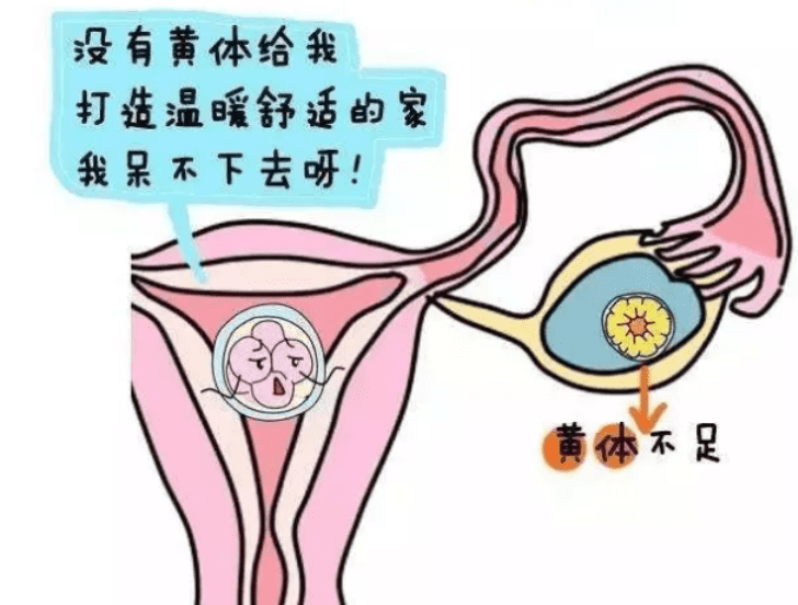 卵巢黄体破裂是什么意思(卵巢黄体为什么会破裂)