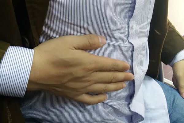 肝不好有哪些症状表现(肝不好的人有什么症状和表现)