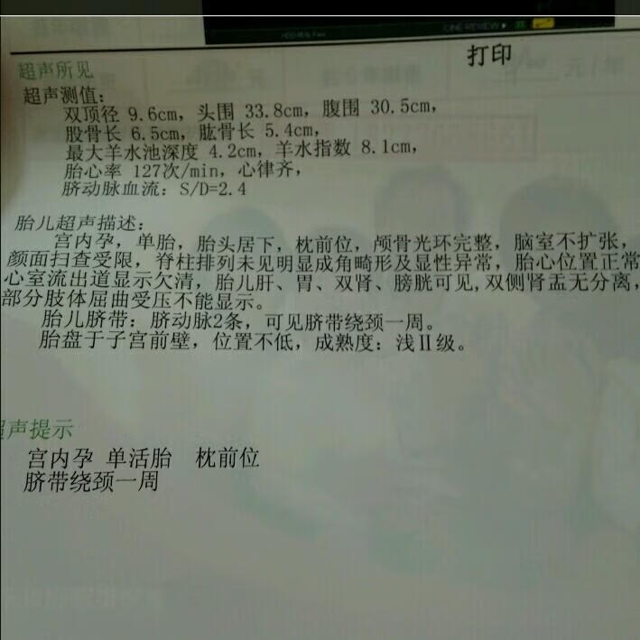 胎儿双顶径是什么意思(男孩女孩双顶径对照表)
