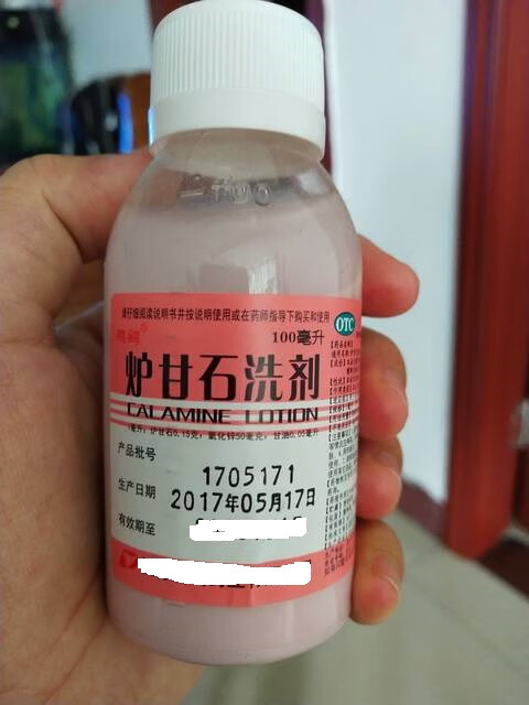 新生儿湿疹用什么药?(新生儿长湿疹用什么药最有效)