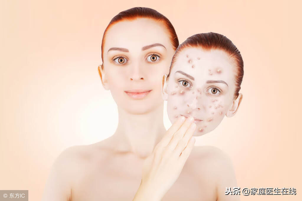 最好的祛斑方法是什么