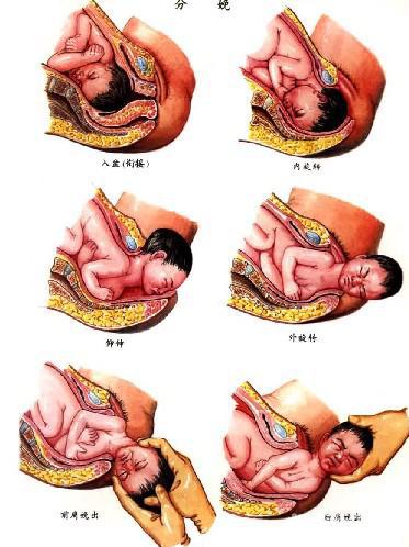 孕妇难产是什么原因引起的(孕妇难产怎么办)
