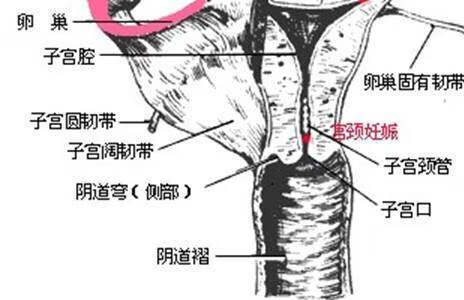 输卵管造影多少钱啊(输卵管造影属于几级痛)