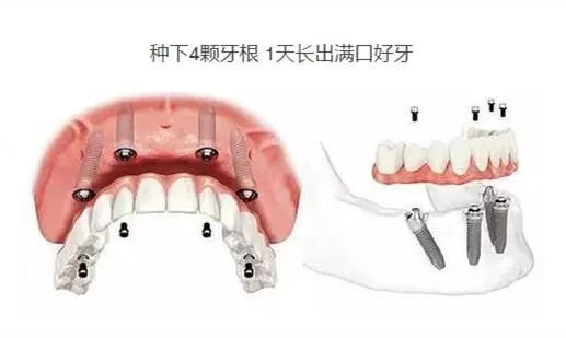 口腔检查报告(口腔医院)
