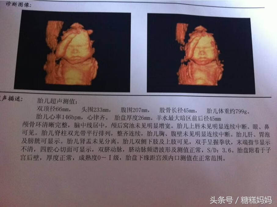 四维的费用有几种(做四维检查要费用)