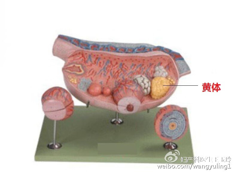 黄体破裂是什么原因造成的是什么东西(黄体破裂怎么引起)