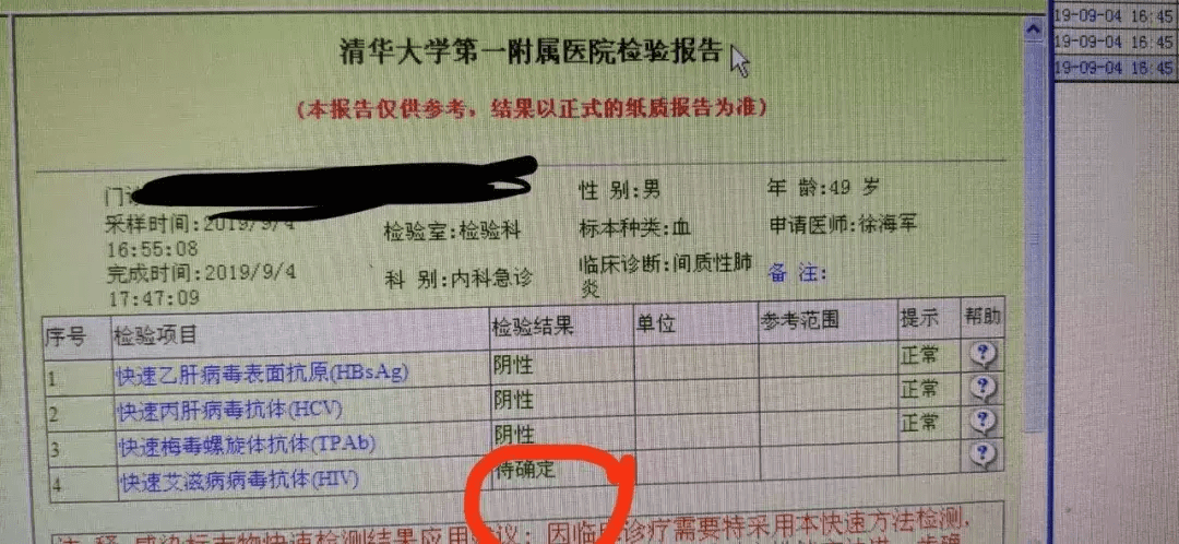 hiv(艾滋病症状图片)