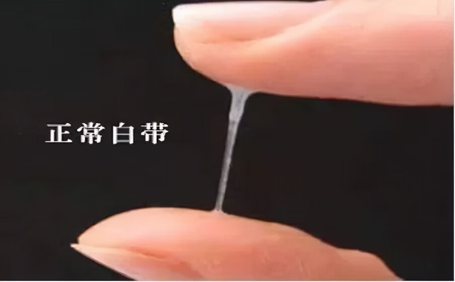 阴道分泌物(妇科炎症对照图)