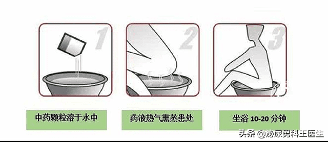 什么叫前列腺炎图片(前列腺在什么位置)