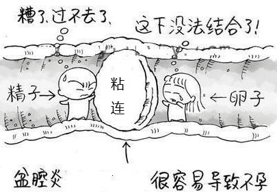 盆腔炎有什么症状呢图片(盆腔炎症有哪些症状)