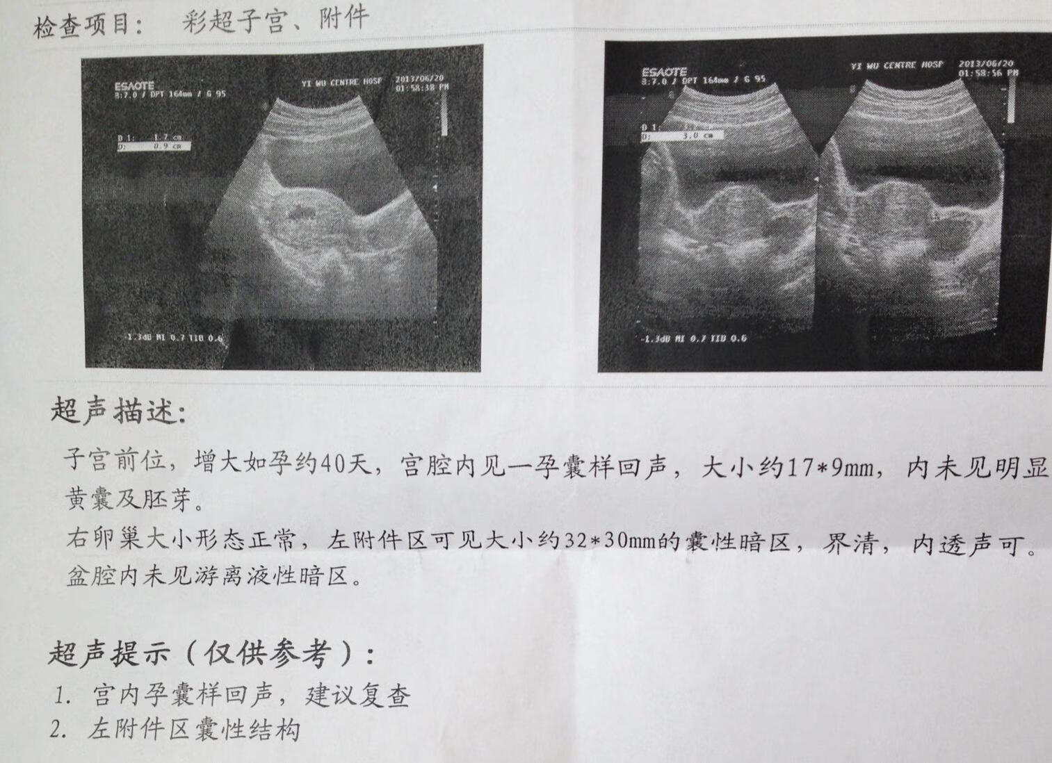 早早孕测试最佳时间是几点(测早孕一天中最佳时间)