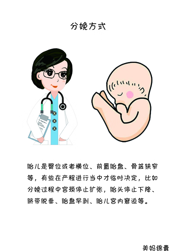 如何分娩婴儿(分娩方法)