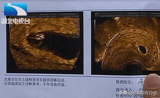 现在做人流需要多少钱(做人流需要多少钱费用)