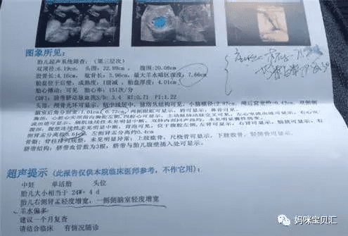 四维彩超怎么看男女图(四维彩超看男女小窍门)