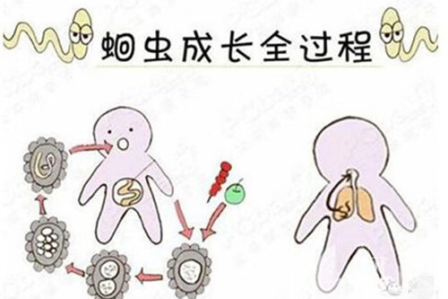 肚子有蛔虫的症状有哪些(肚子蛔虫病的症状有哪些)