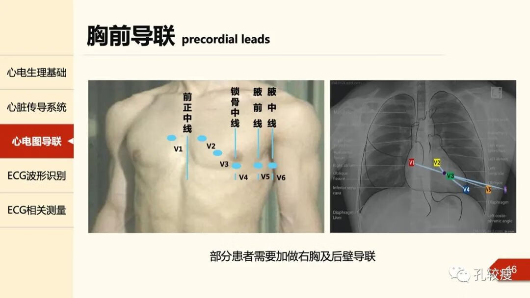 心电图导联位置示意图(心电图机导联位置图)