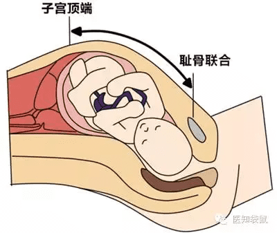 產檢胎位roa是什麼意思胎位roa是什麼位置