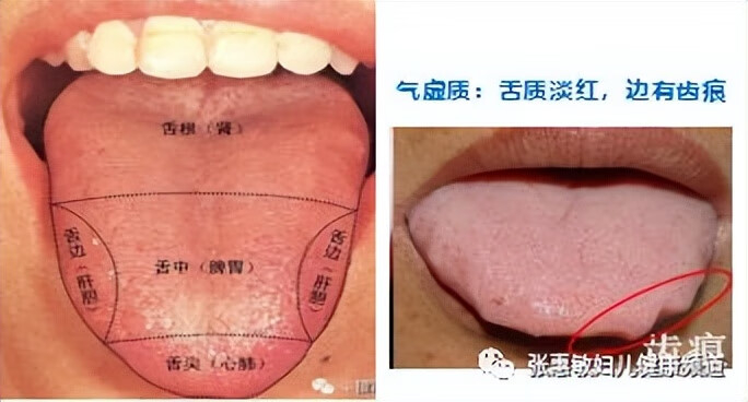 女性疾病有哪几种(女性常见疾病)