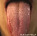 海螵蛸的副作用是什么(海螵蛸副作用都有哪些)