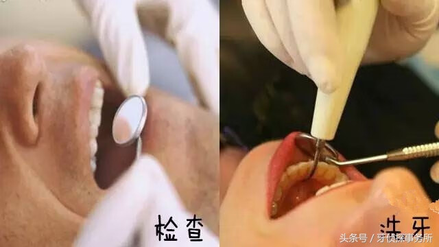 冷光牙齿美白原理(冷光美白对牙齿有伤害吗)