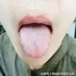 海螵蛸的副作用是什么(海螵蛸副作用都有哪些)