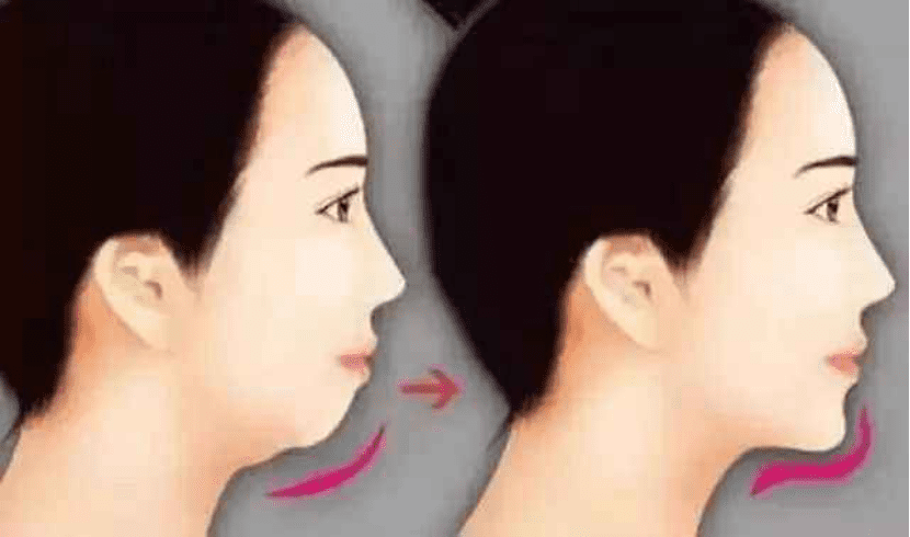 玻尿酸是什么东西(玻尿酸啥意思)