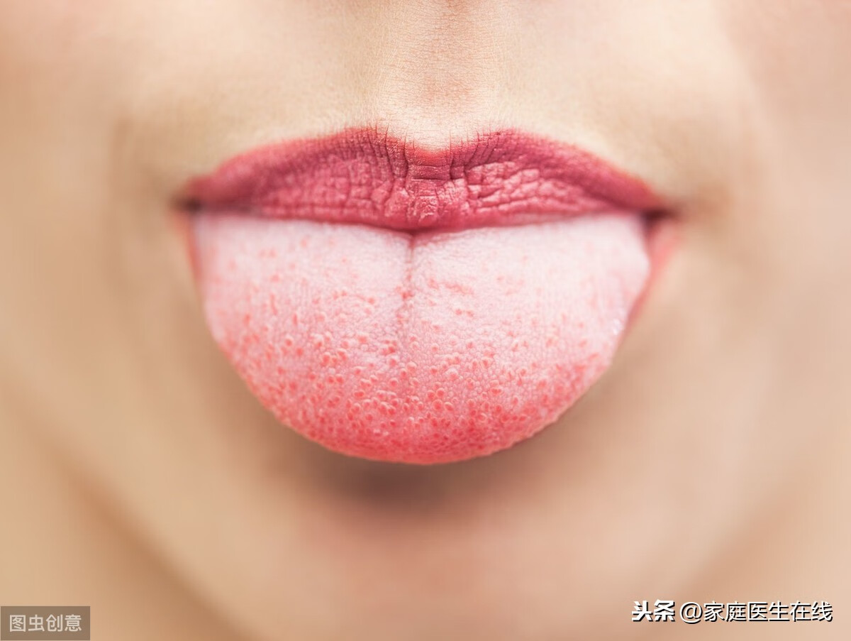 舌苔发黄的原因有哪些(舌苔发黄怎么调理改善)