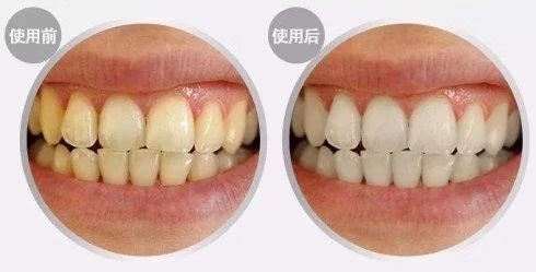 柠檬可以美白牙齿吗?(柠檬可以美白吗)