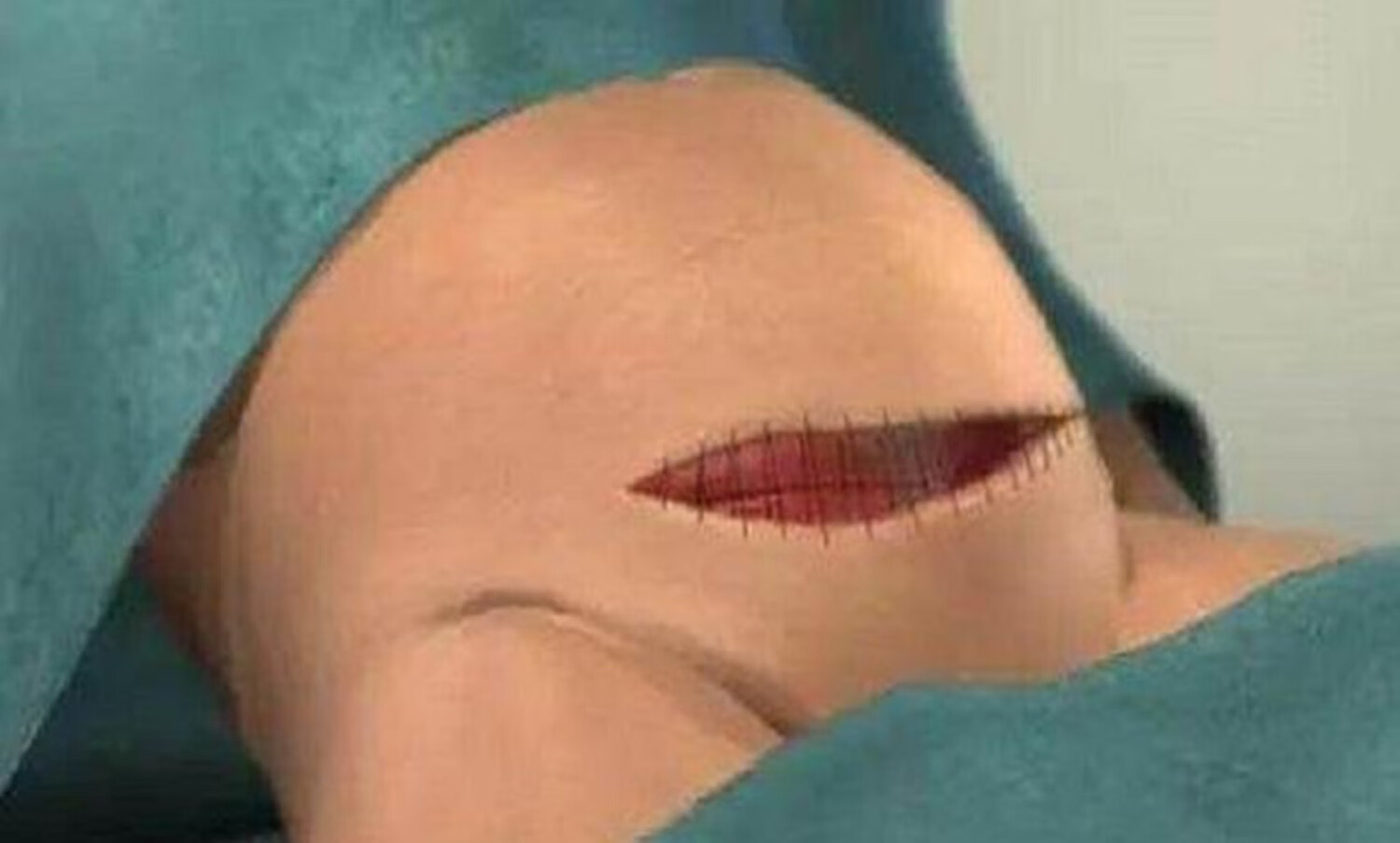 剖宫产和剖腹产的区别(剖腹产坐月子十大禁忌)