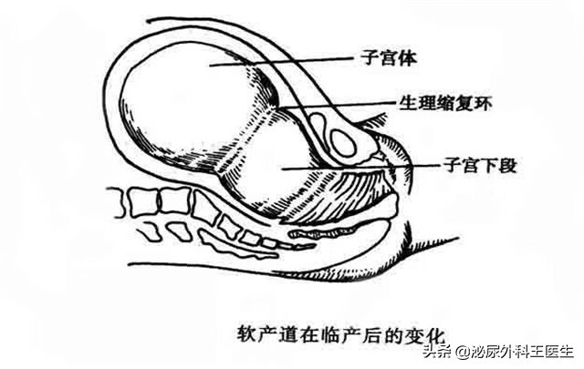 切除子宫 影响