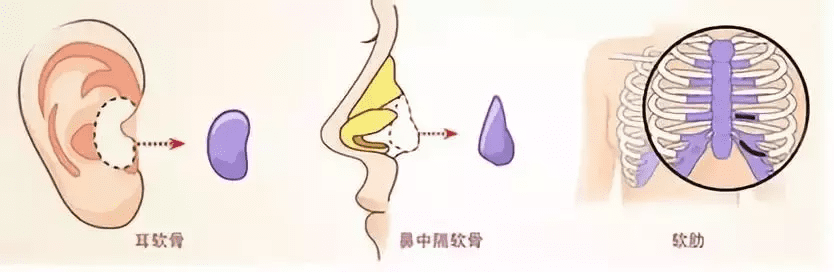 隆鼻精油吧(隆鼻精油真的有用吗)