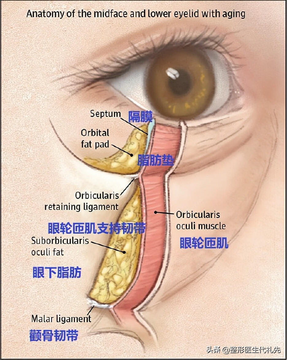 祛除眼袋方法(6种方法有效消除眼袋)