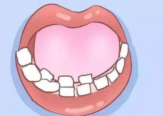 儿童换牙先换上面还是下面(儿童牙齿怎么换牙)