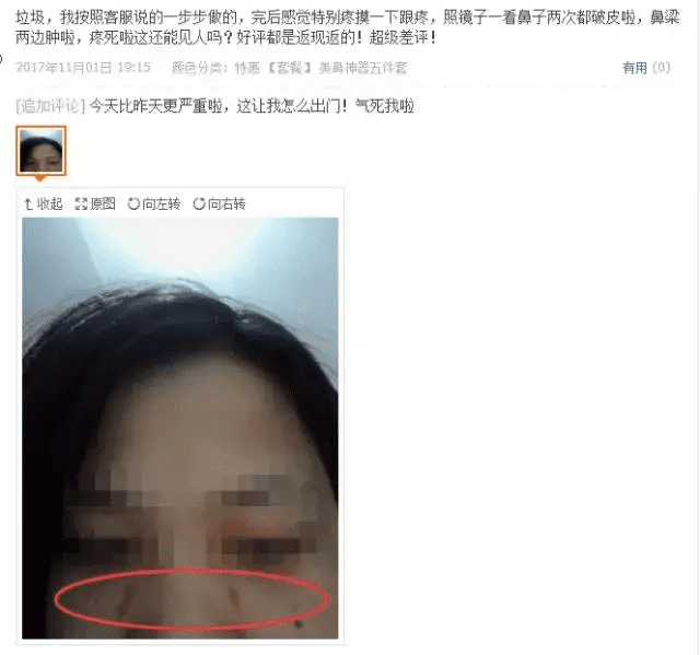 隆鼻精油吧(隆鼻精油真的有用吗)