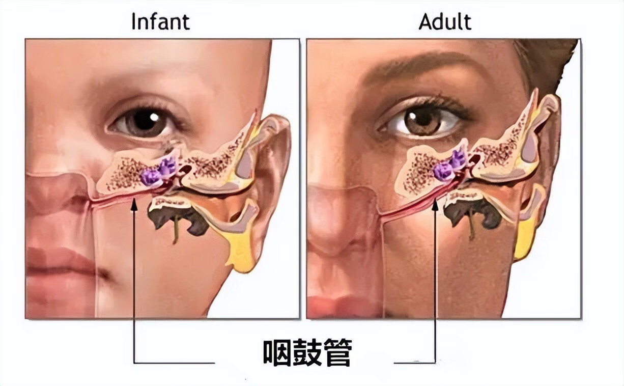 突然耳朵痛是什么原因(耳朵外廓痛是什么原因)