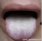 海螵蛸的副作用是什么(海螵蛸副作用都有哪些)