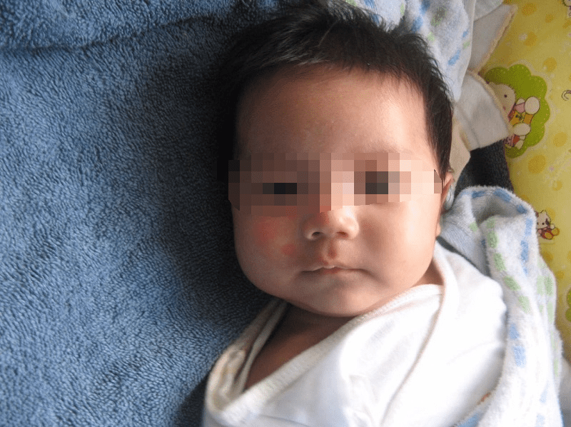 轮状病毒感染腹泻一般要多久痊愈宝宝知道轮(如何判断宝宝轮状病毒)