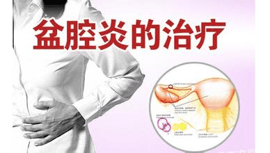 盆腔炎有什么症状呢图片(盆腔炎症有哪些症状)