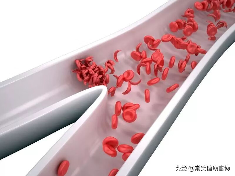 红细胞平均体积是什么意思(红细胞平均体积偏高是啥意思)
