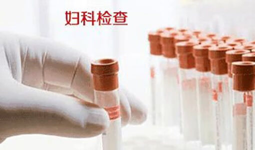 分泌物常规检查多少钱(检查白带多少钱)