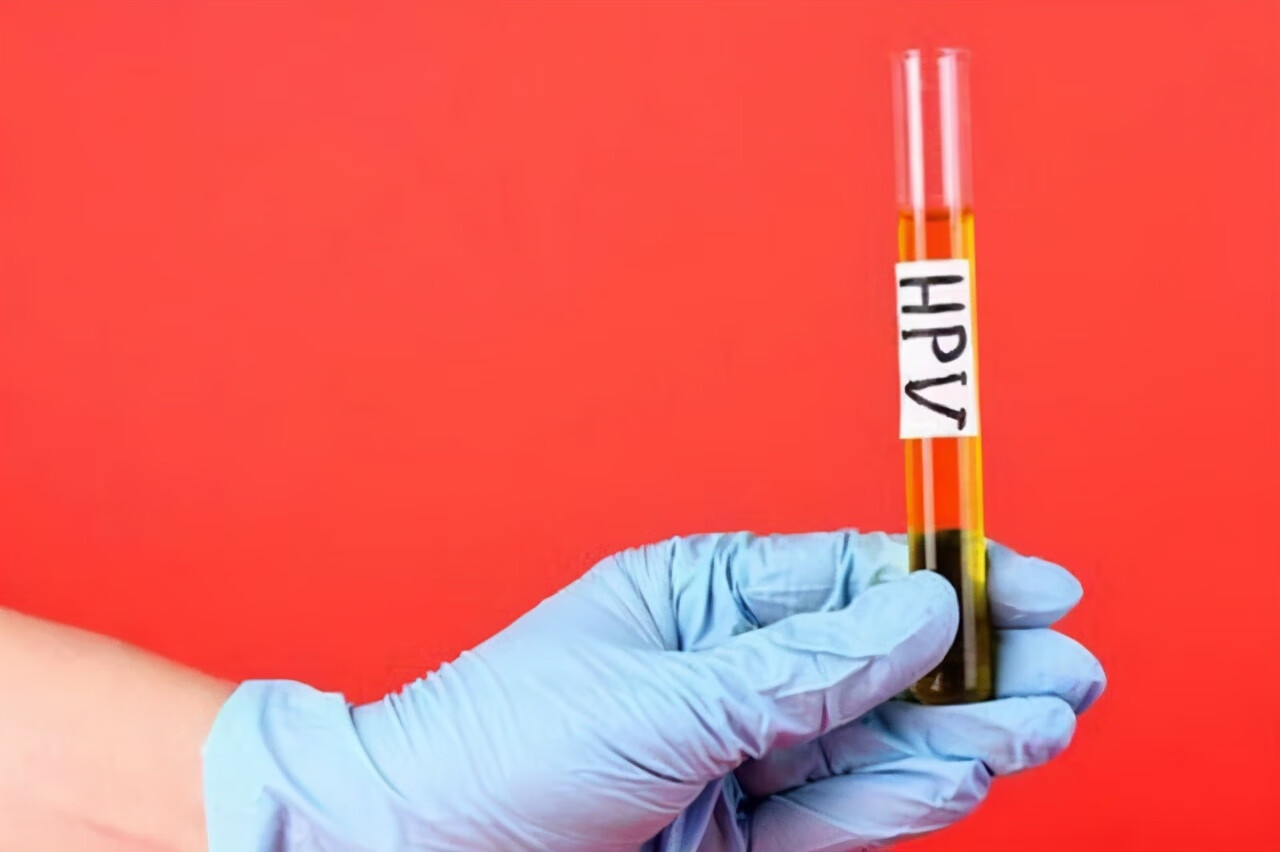 hpv病毒感染是什么病(hpv病毒发现)