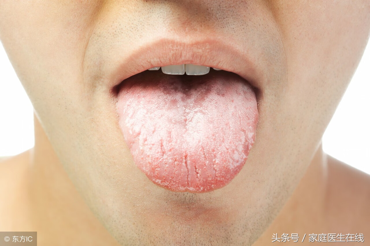舌头发麻(年轻人舌头发麻)