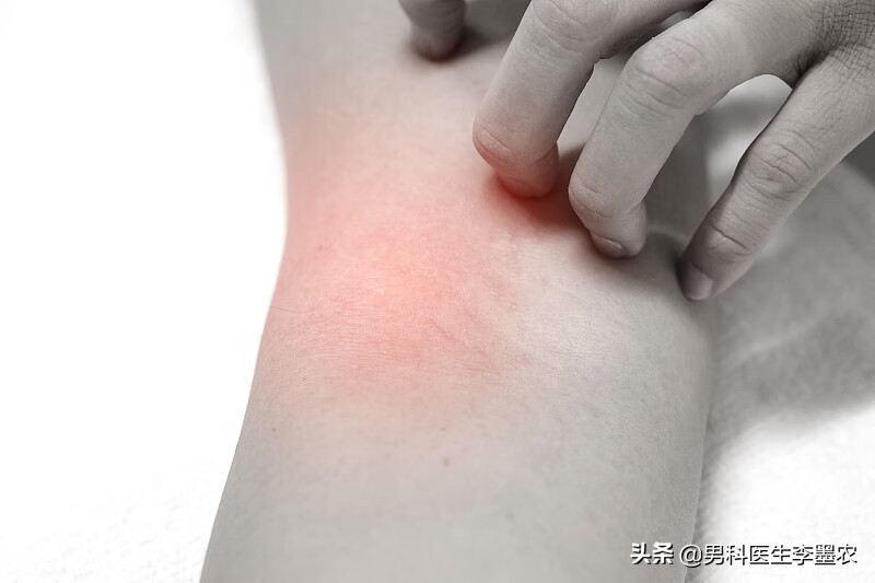 阴囊潮湿怎么回事儿(西医解释阴囊潮湿)
