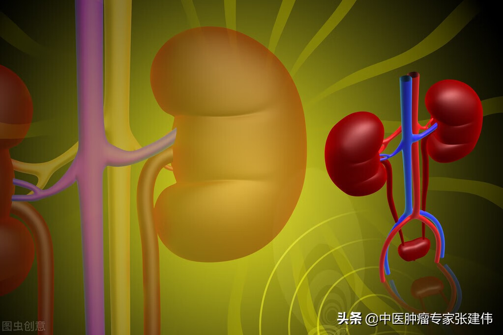 肾癌症状百科(肾癌早期的症状有哪些)